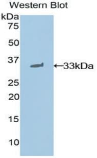 STAT1 Antibody (aa432-680)