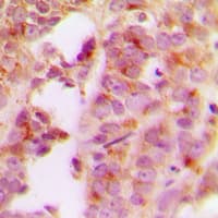 IRS1 Antibody (Internal)