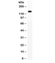 ATXN2 / SCA2 / Ataxin-2 Antibody