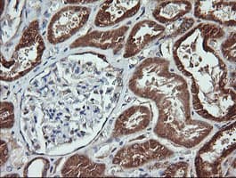 ACAA2 Antibody (clone OTI3C6)