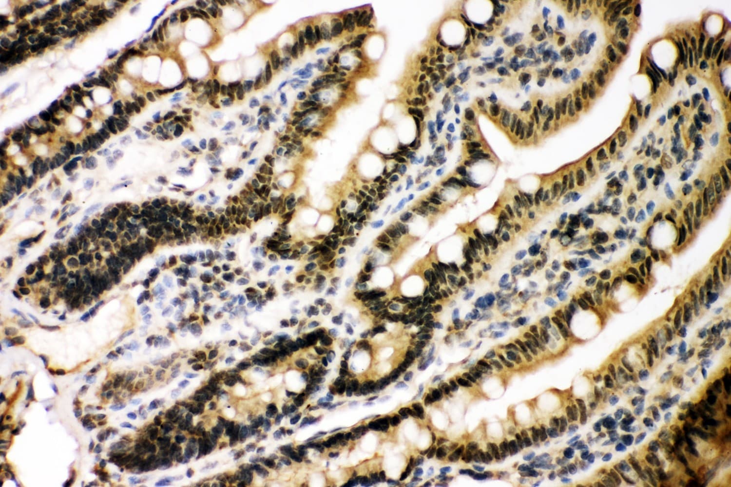 EP300 / p300 Antibody (aa2065-2414)