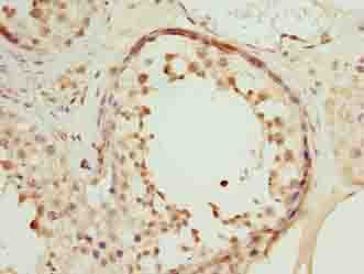 SPDL1 / CCDC99 Antibody