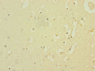 Polyclonal Rabbit anti-Human SCN8A / Nav1.6 Antibody (IHC)