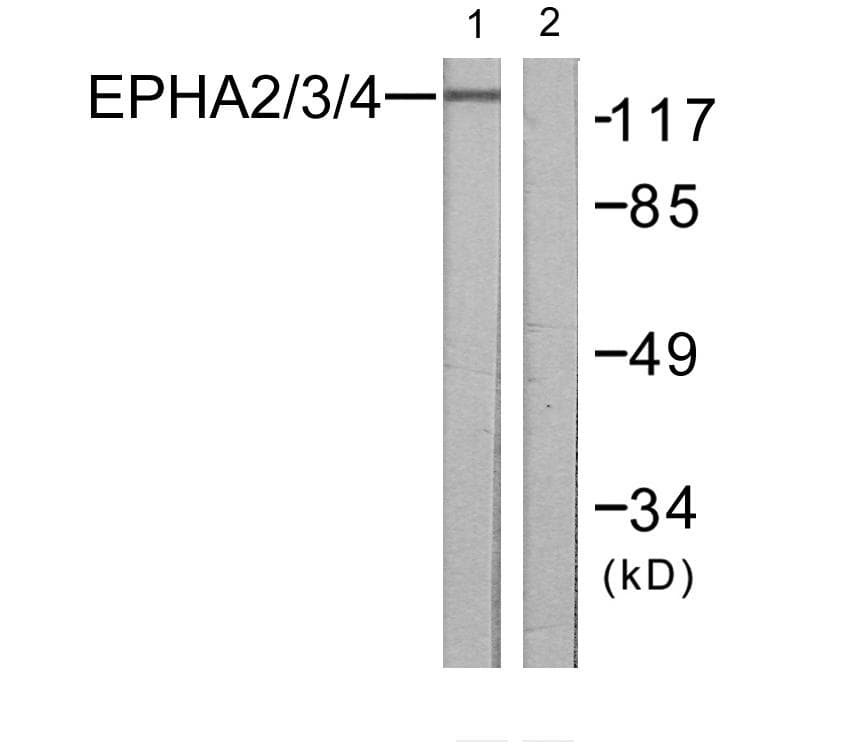 EPH Receptor A2+A3+A4 Antibody (p588/596)