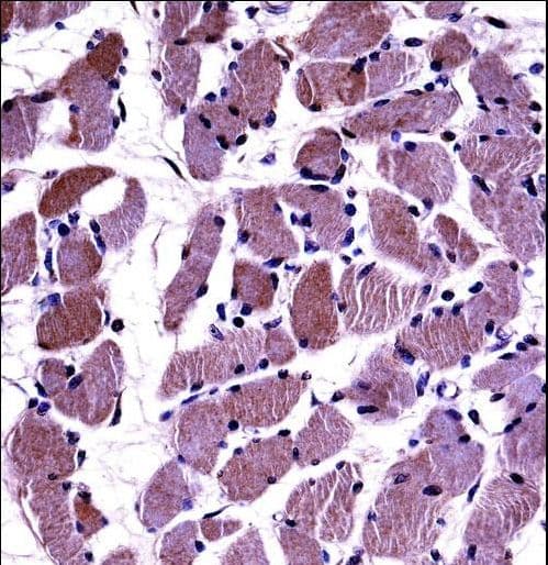 DAG1 / Dystroglycan Antibody (aa718-747)