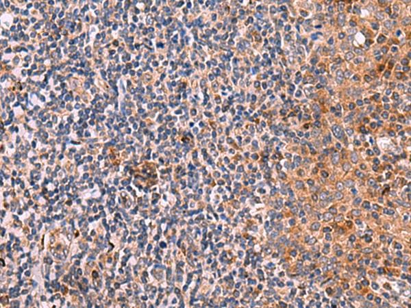 KLK9 / Kallikrein 9 Antibody
