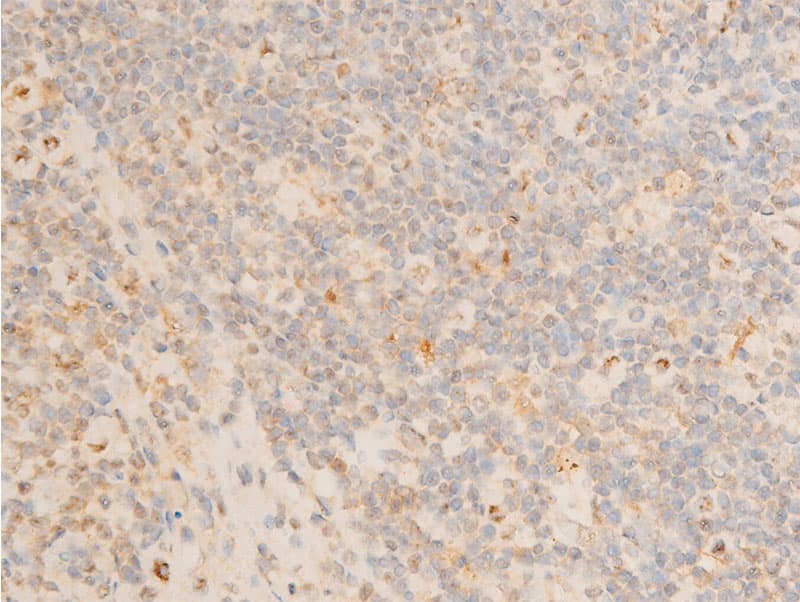PDPK1 / PDK1 Antibody (phospho-Ser241)