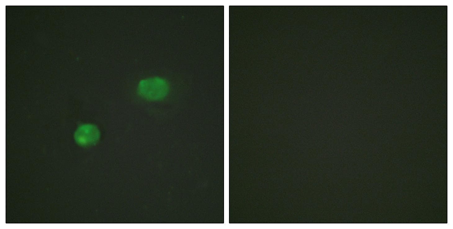 Polyclonal Rabbit anti-Human JUN / c-Jun Antibody (p231, IHC, IF, WB)