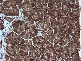MAP2K1 / MKK1 / MEK1 Antibody (clone OTI2A1, Carrier-free)