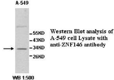 Polyclonal Rabbit anti-Human ZNF146 Antibody (aa1-292, WB)