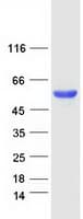 Human PTEN Protein (Recombinant Myc-DDK (Flag))