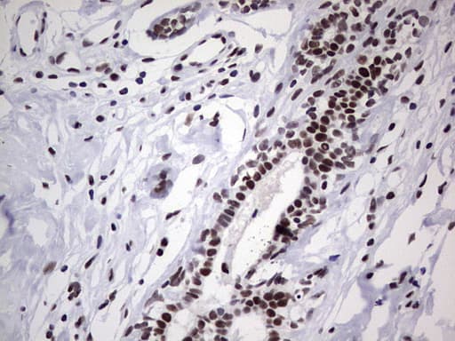 Monoclonal Mouse anti-Human PPP1R8 / Rnase E Antibody (clone OTI4E5, aa1-225, IHC, WB)