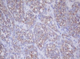 Monoclonal Mouse anti-Human IF3mt / MTIF3 Antibody (clone OTI1D6, IHC, WB)