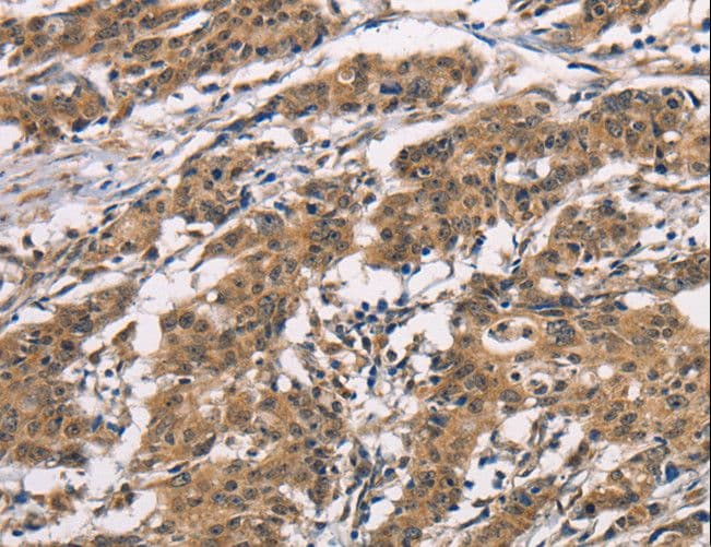 ADGRB1 / BAI1 Antibody