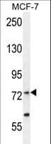 Polyclonal Rabbit anti-Human RARS Antibody (aa605-634, IHC, IF, WB)