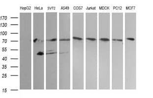 PathPlus™ NCAM / CD56 Antibody (aa20-718, clone 1G4)