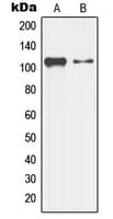 IHC-plus™ MAP3K13 / LZK Antibody (aa166-205)
