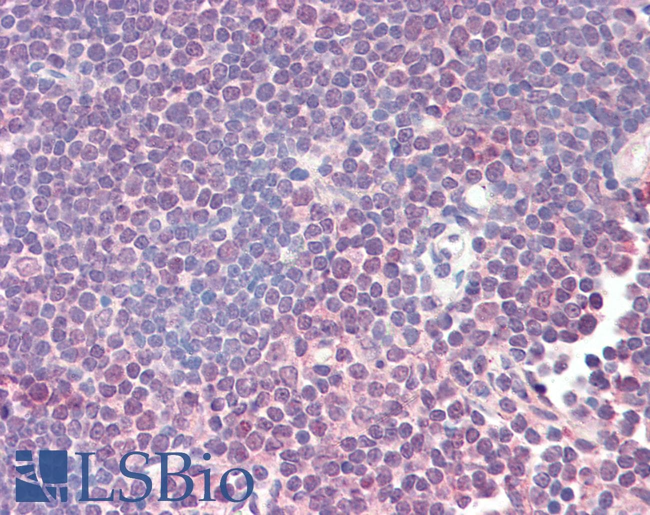 IHC-plus™ ZAP70 Antibody (clone 11H40)