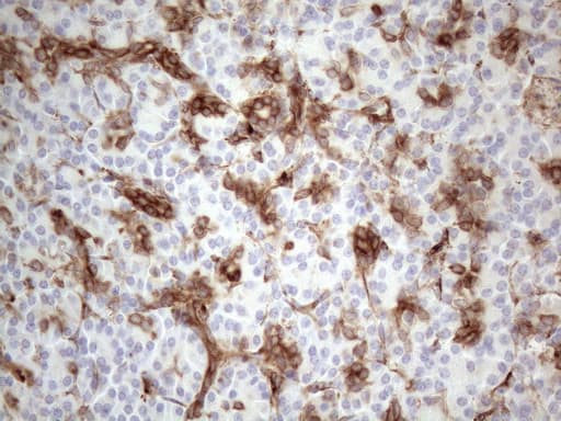 LPIN1 / Lipin 1 Antibody (clone OTI7F5)