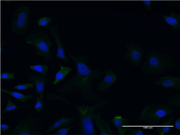 LCAT Antibody (clone 4A9)