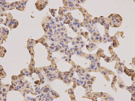 IHC-plus™ PSMA3 Antibody