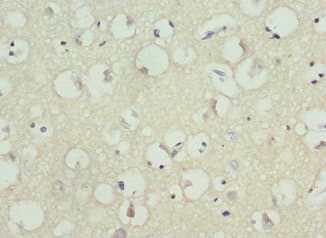 Polyclonal Rabbit anti-Human Kv10.1 / KCNH1 Antibody (IHC)