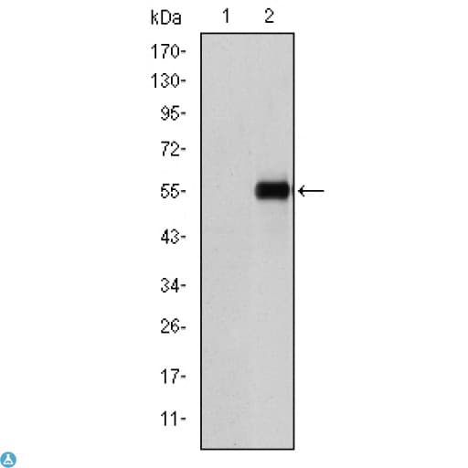 CD105 Antibody