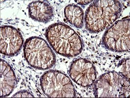 HSD17B4 Antibody (clone OTI1F3)