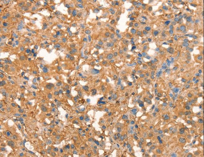 Polyclonal Rabbit anti-Human CRELD1 Antibody (IHC, WB)