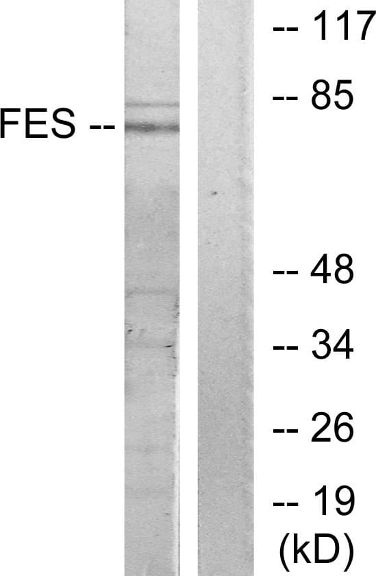 FES Antibody (aa131-180)
