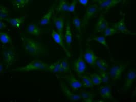 IHC-plus™ H6PD / G6PDH Antibody (clone 1H6)
