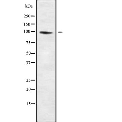 Polyclonal Rabbit anti-Human MPHOSPH8 Antibody (WB)