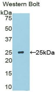 USAG1 / SOSTDC1 Antibody (aa24-206, APC)