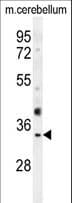 Polyclonal Rabbit anti-Human OR51I1 Antibody (aa284-313, WB)