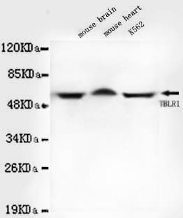 TBL1XR1 / TBLR1 Antibody