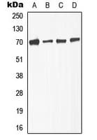 TGFBR2 Antibody (phospho-Ser225)