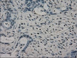 CRYAB / Alpha B Crystallin Antibody (clone OTI3C2)