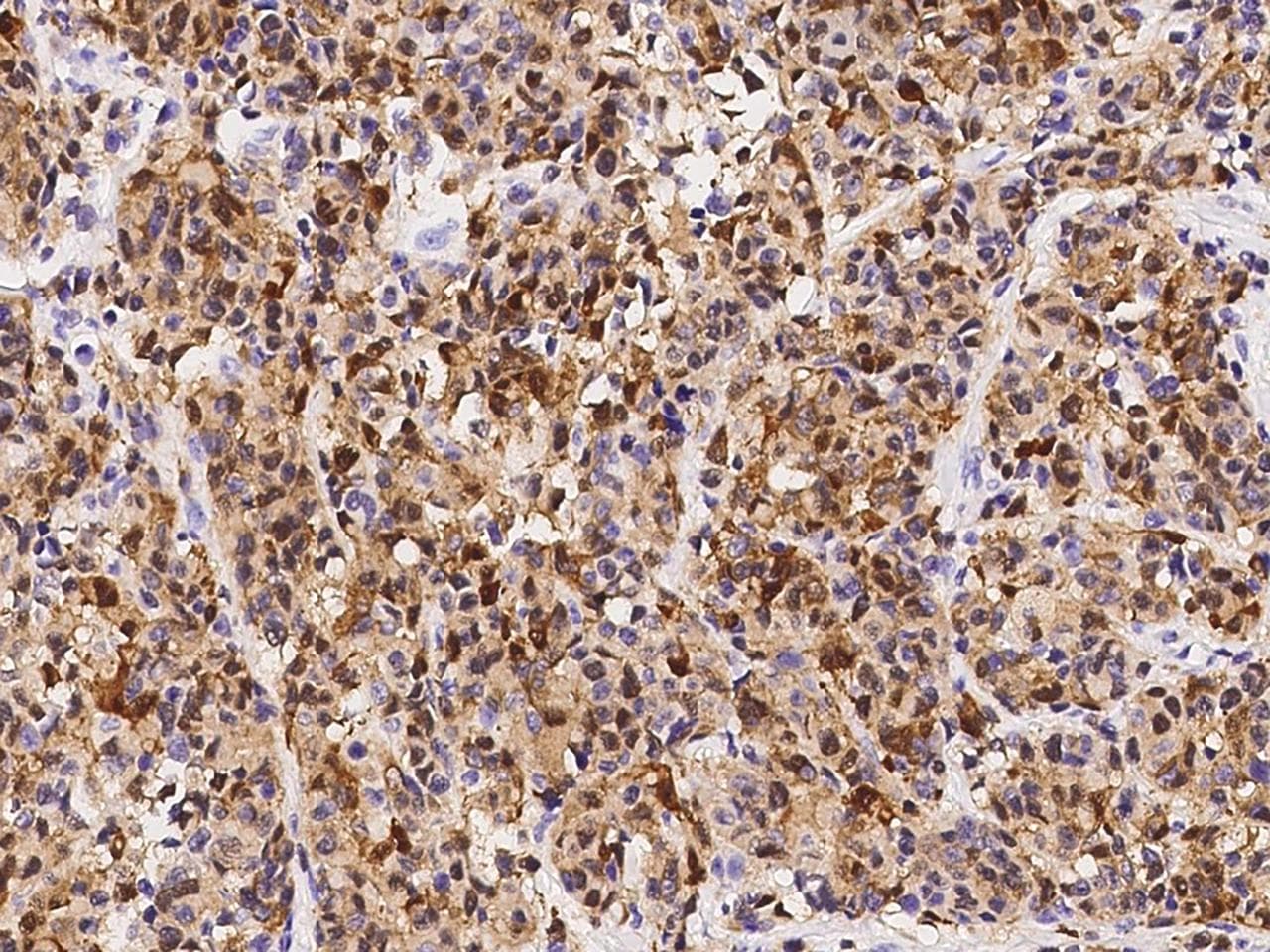 S100B / S100 Beta Antibody