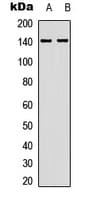 Polyclonal Rabbit anti-Human PPP1R12A / MYPT1 Antibody (phospho-Thr853, IHC, WB)
