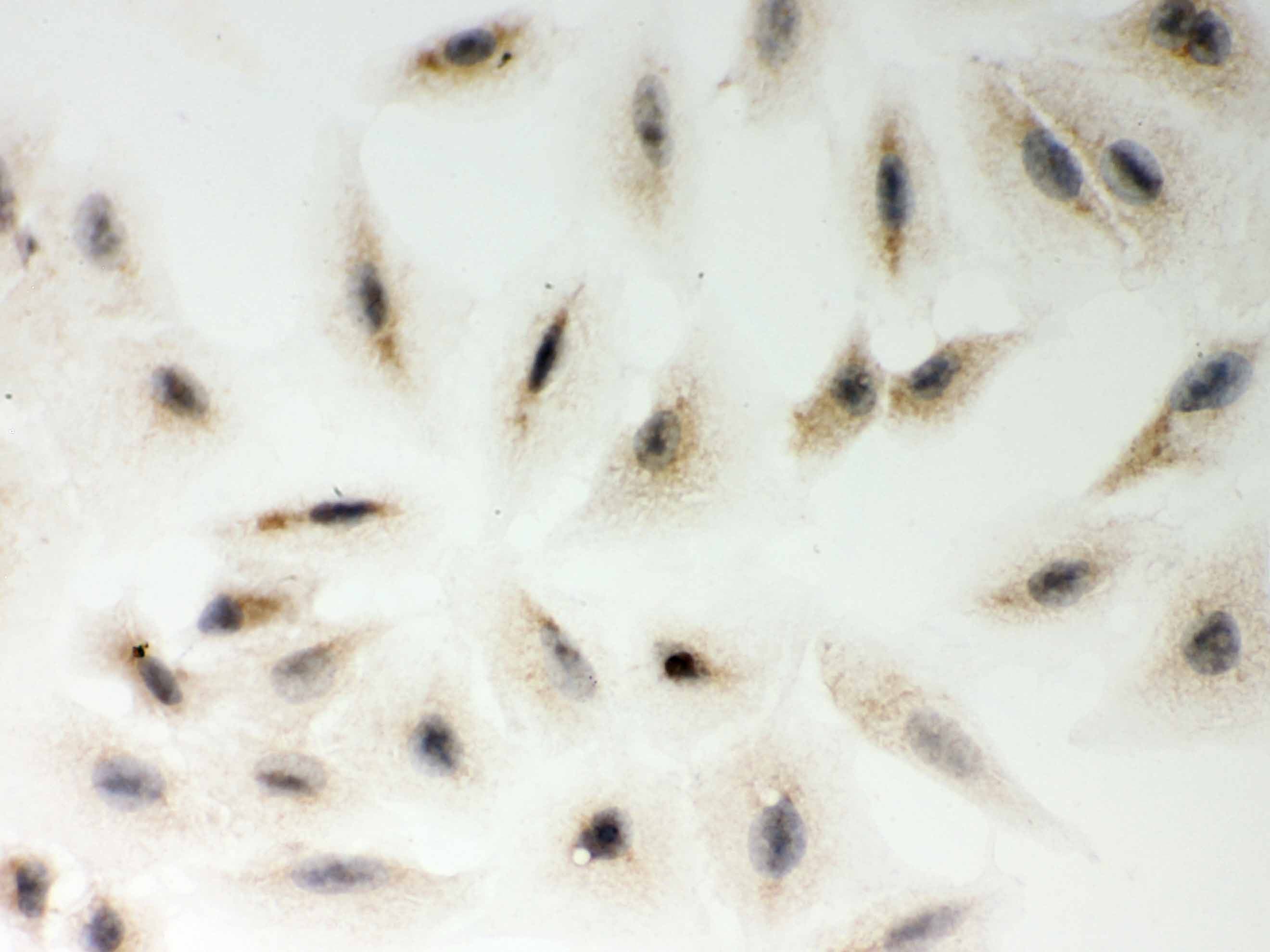 Polyclonal Rabbit anti-Human MTDH / Metadherin Antibody (aa101-270, IHC, WB)