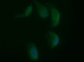SYP / Synaptophysin Antibody (clone OTI5H2, Carrier-free)