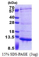 Human PET117 Protein (Recombinant His)