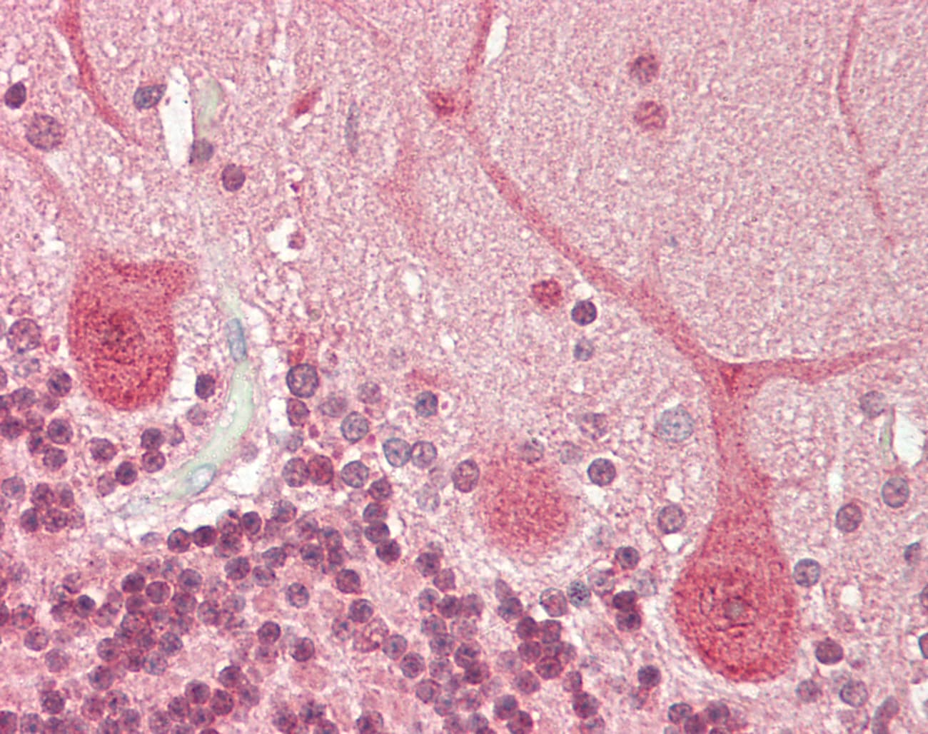 MECP2 Antibody (C-Terminus)