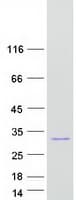 Human UBE2E2 / UBCH8 Protein (Recombinant Myc-DDK (Flag))