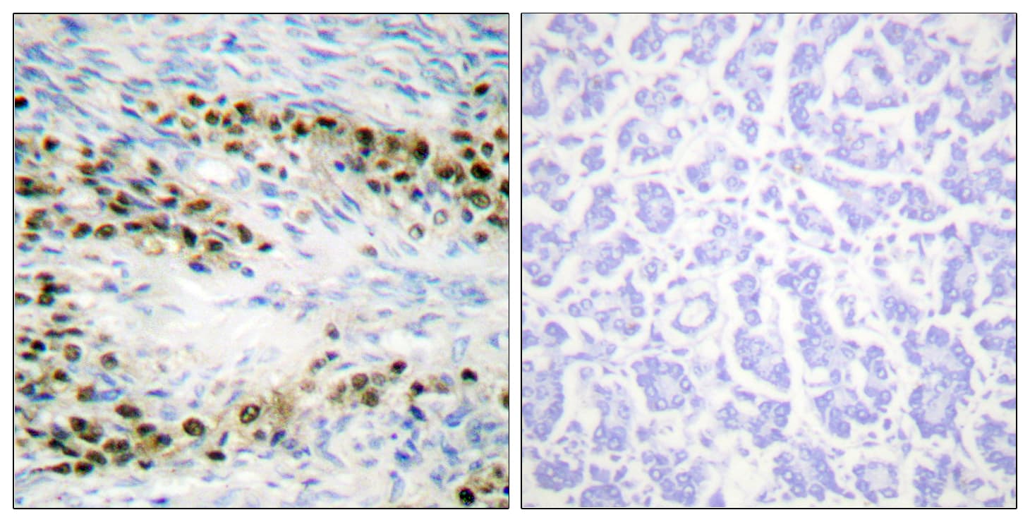 AKT1 Antibody (aa38-87)