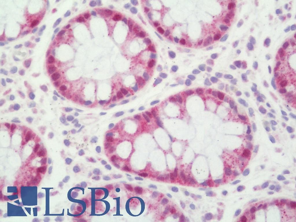 FOXP2 Antibody (clone 11C1034)