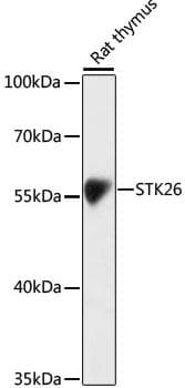 Polyclonal Rabbit anti-Human STK26 / MST4 Antibody (WB)