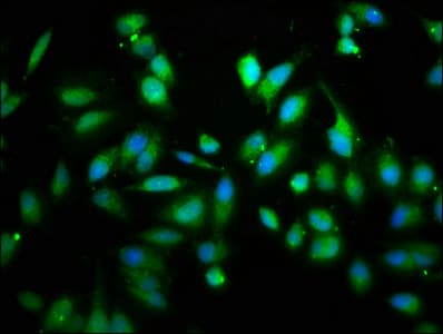 Polyclonal Rabbit anti-Human RICK / RIP2 Antibody (WB)