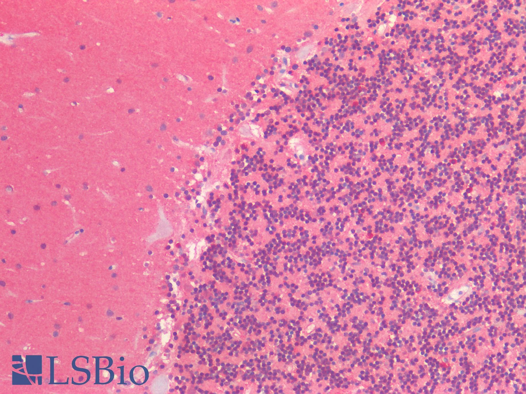 IHC-plus™ Monoclonal Mouse anti-Human HSP70 / Heat Shock Protein 70 Antibody (clone 5C3, IHC, IF, WB)