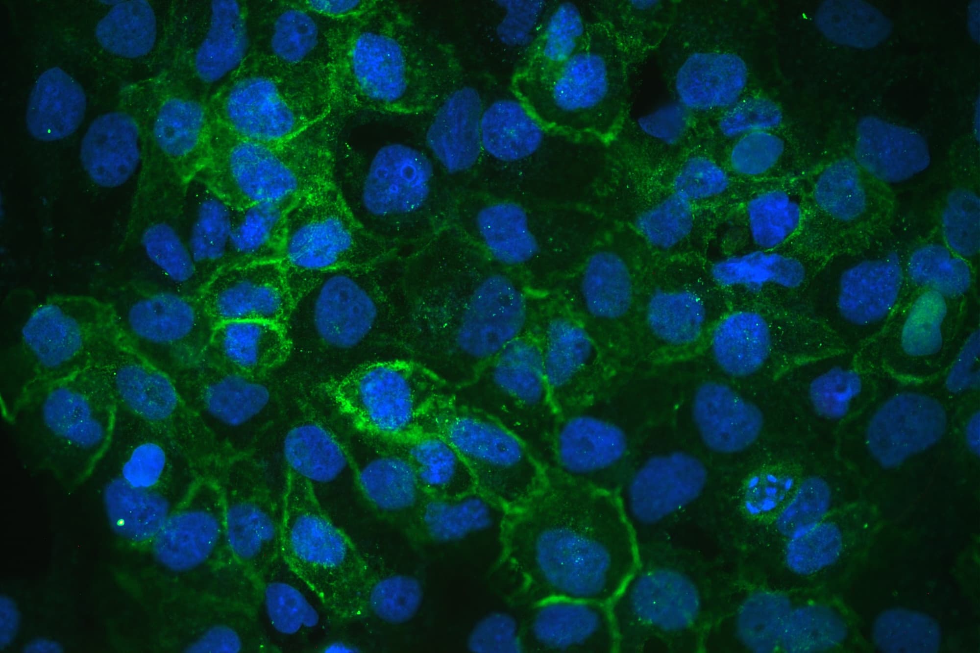 Polyclonal Rabbit anti-Human ITGA3 / CD49c Antibody (IHC, WB)